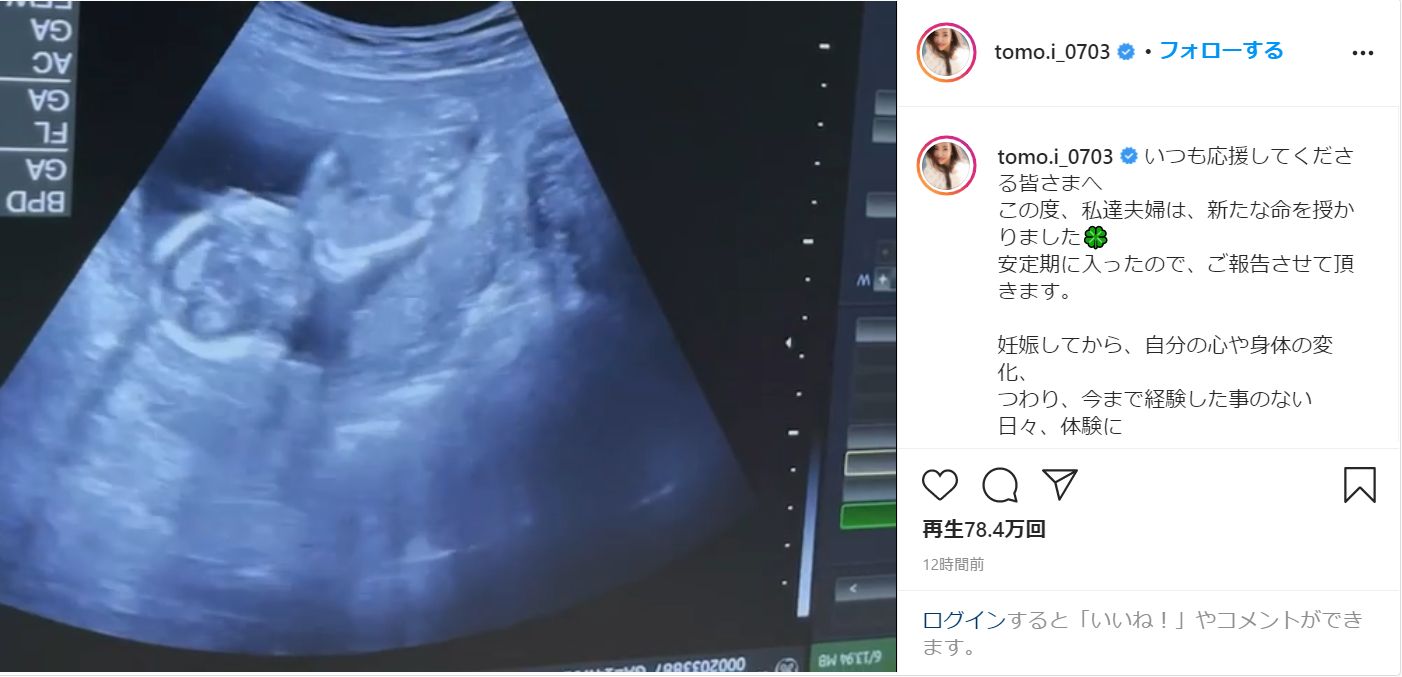 板野友美、第1子妊娠を発表！エコー動画に「動いてる！」と驚き